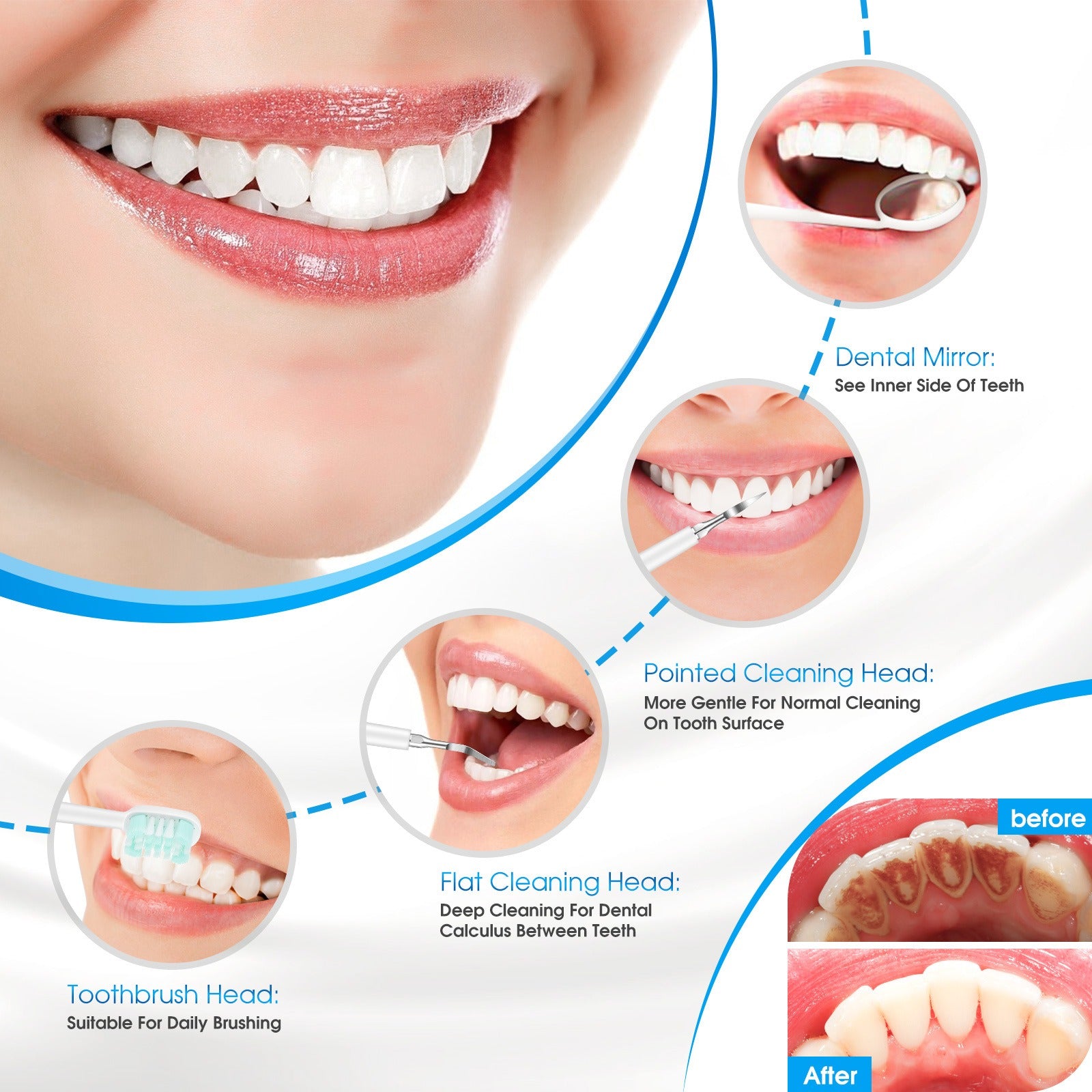 Portable Electric Dental Scaler