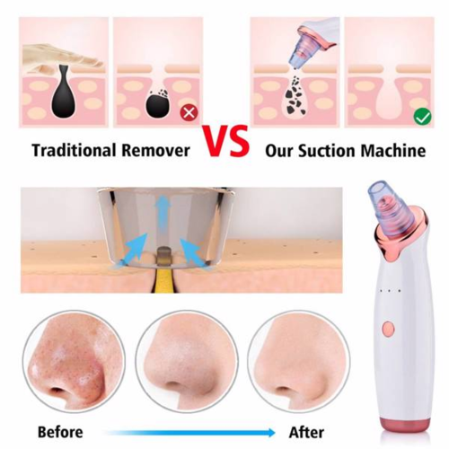 Electric Blackhead Vacuum Facial Cleaner